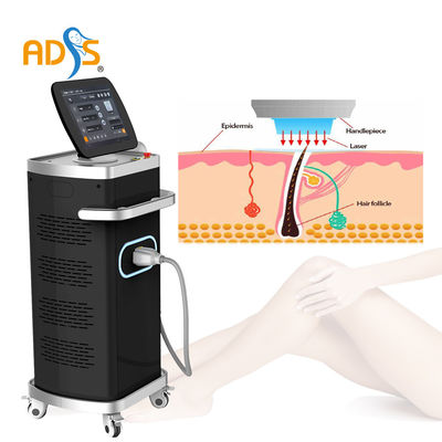ADSS 공장 다이오드 레이저 털 제거 기계 808nm 755nm 940nm 1064nm 4 사고 방식