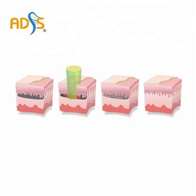 OEM / ODM Q스위치 야그 레이저 귀영 나팔 제거 기계 2년 보증